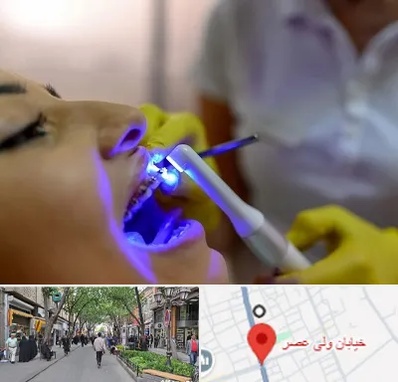 دندانپزشکی با لیزر در ولیعصر شهریار