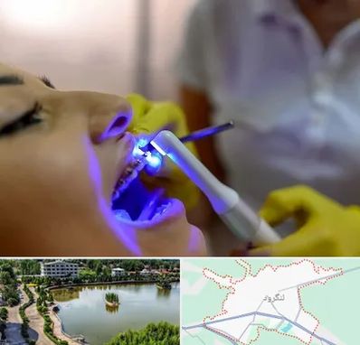 دندانپزشکی با لیزر در لنگرود