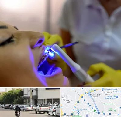 دندانپزشکی با لیزر در قدوسی شرقی شیراز