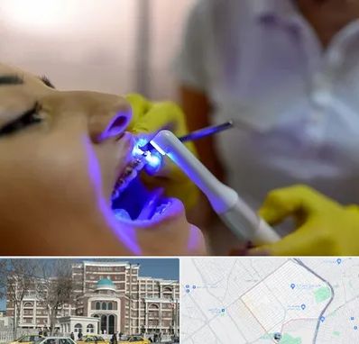 دندانپزشکی با لیزر در طلاب مشهد