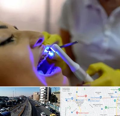 دندانپزشکی با لیزر در پیروزی 