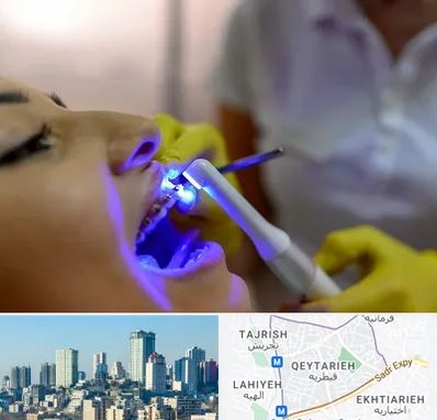 دندانپزشکی با لیزر در قیطریه 