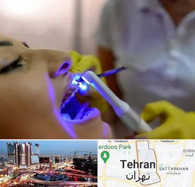 دندانپزشکی با لیزر در صادقیه 