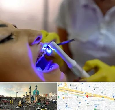 دندانپزشکی با لیزر در رسالت