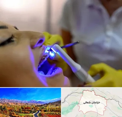 دندانپزشکی با لیزر در خراسان شمالی