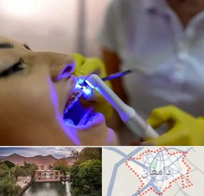 دندانپزشکی با لیزر در دامغان