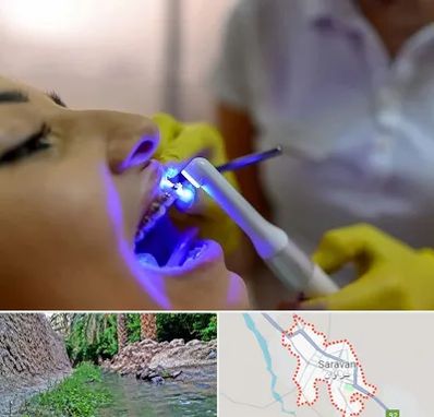 دندانپزشکی با لیزر در سراوان