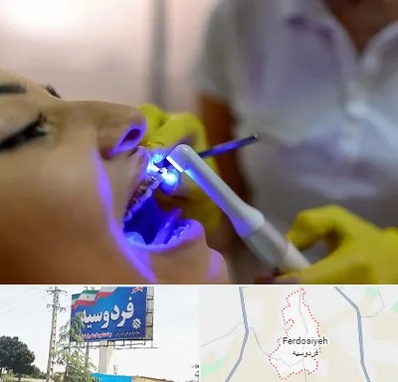 دندانپزشکی با لیزر در فردوسیه شهریار