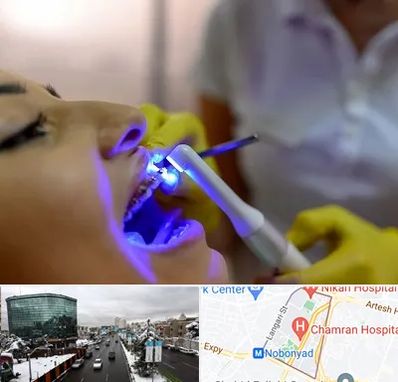 دندانپزشکی با لیزر در اقدسیه 