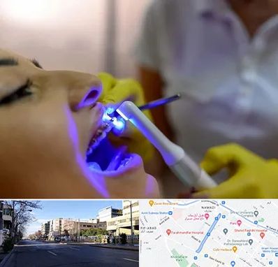 دندانپزشکی با لیزر در خیابان ملاصدرا شیراز