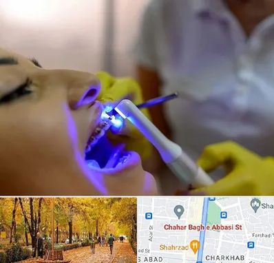 دندانپزشکی با لیزر در چهارباغ اصفهان