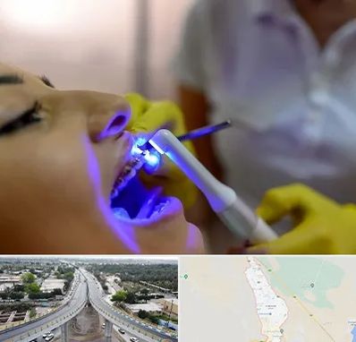 دندانپزشکی با لیزر در اندیمشک