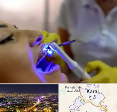 دندانپزشکی با لیزر در کرج