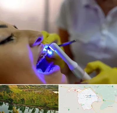 دندانپزشکی با لیزر در بهبهان