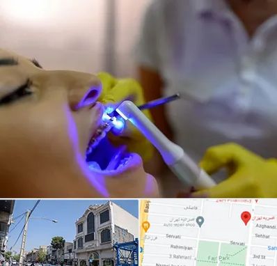 دندانپزشکی با لیزر در افسریه 