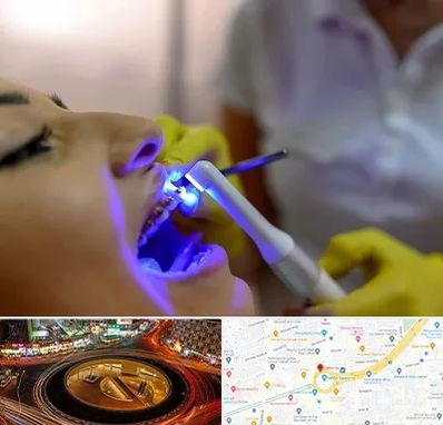 دندانپزشکی با لیزر در میدان ولیعصر