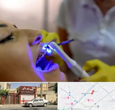 دندانپزشکی با لیزر در باجک قم