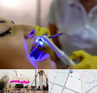 دندانپزشکی با لیزر در پادادشهر اهواز