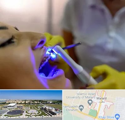 دندانپزشکی با لیزر در ملارد