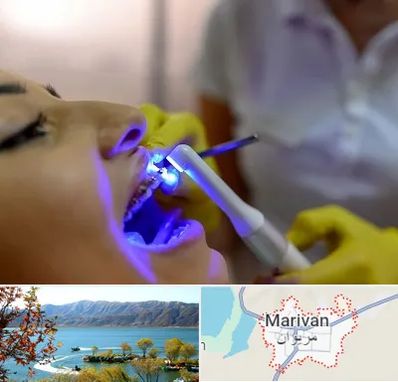 دندانپزشکی با لیزر در مریوان