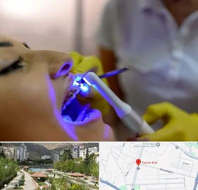 دندانپزشکی با لیزر در بلوار تعاون