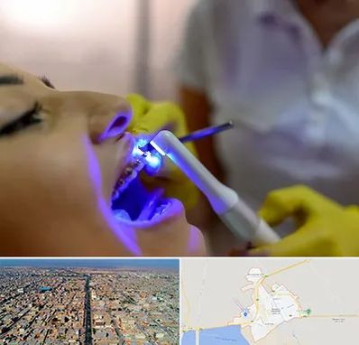 دندانپزشکی با لیزر در بندر ماهشهر