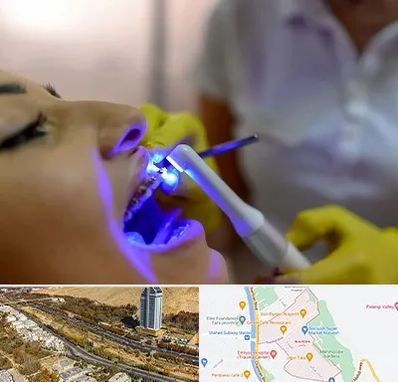 دندانپزشکی با لیزر در خیابان نیایش شیراز
