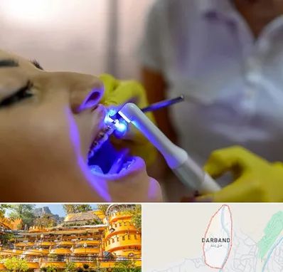 دندانپزشکی با لیزر در دربند