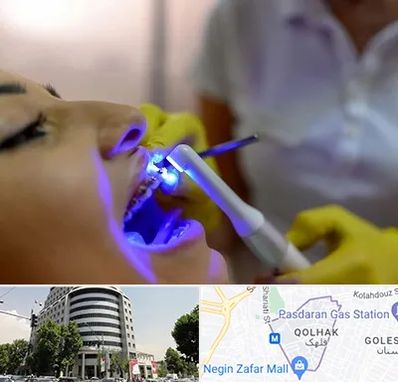 دندانپزشکی با لیزر در قلهک 