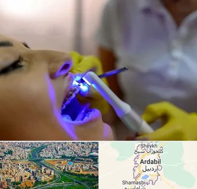 دندانپزشکی با لیزر در اردبیل