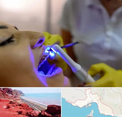 دندانپزشکی با لیزر در هرمزگان