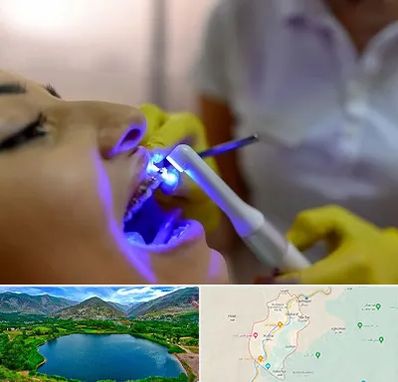 دندانپزشکی با لیزر در رودبار