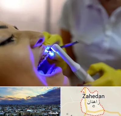 دندانپزشکی با لیزر در زاهدان