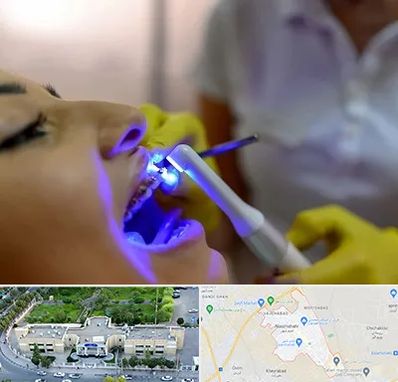 دندانپزشکی با لیزر در نسیم شهر