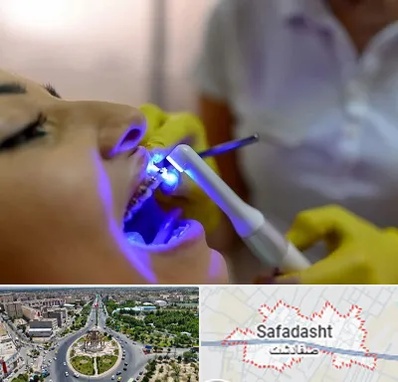 دندانپزشکی با لیزر در صفادشت