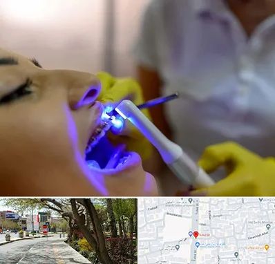 دندانپزشکی با لیزر در خیابان توحید اصفهان