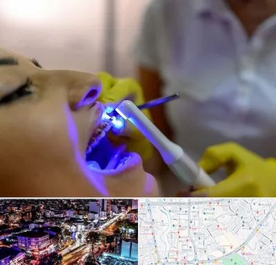 دندانپزشکی با لیزر در منظریه رشت