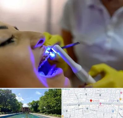 دندانپزشکی با لیزر در هشت بهشت اصفهان