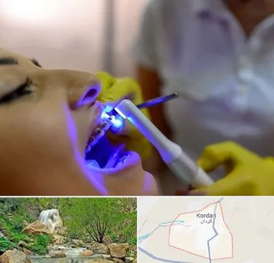 دندانپزشکی با لیزر در کردان