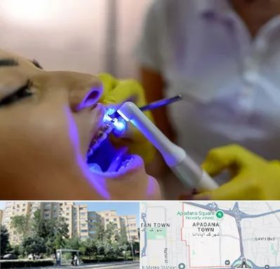 دندانپزشکی با لیزر در آپادانا