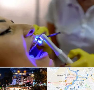 دندانپزشکی با لیزر در کیانپارس اهواز