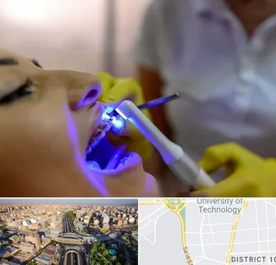 دندانپزشکی با لیزر در استاد معین 