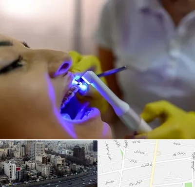 دندانپزشکی با لیزر در زرتشت