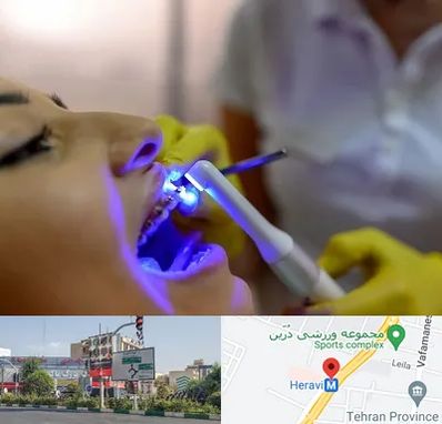 دندانپزشکی با لیزر در هروی 