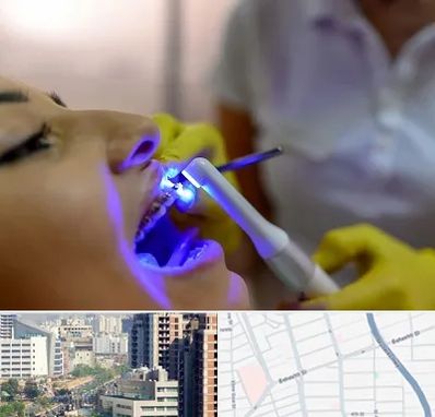 دندانپزشکی با لیزر در خیابان بهشتی