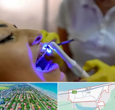 دندانپزشکی با لیزر در نور