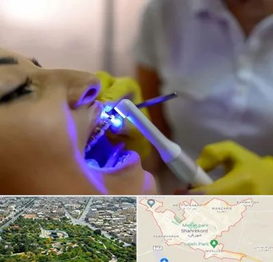 دندانپزشکی با لیزر در شهرکرد