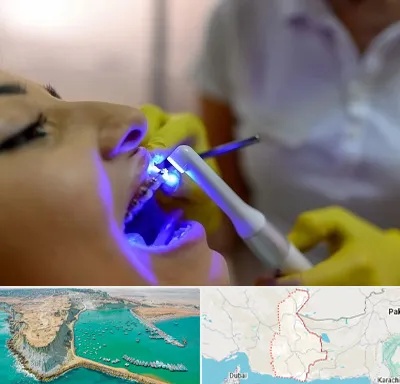 دندانپزشکی با لیزر در سیستان و بلوچستان