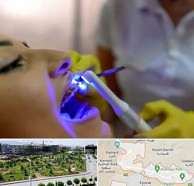 دندانپزشکی با لیزر در پردیس