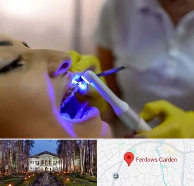 دندانپزشکی با لیزر در باغ فردوس